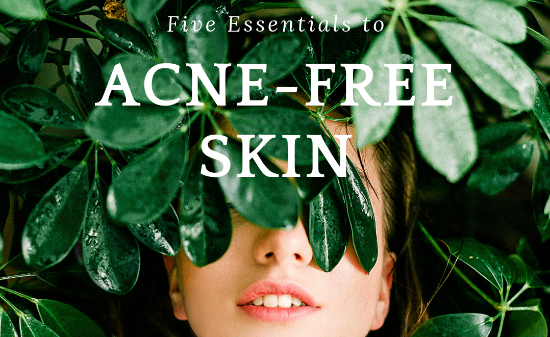 Five Essentials for Acne-Free Skin